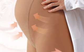 Как подобрать компрессионные чулки или колготки для операции, родов или против варикоза? Полезные советы.